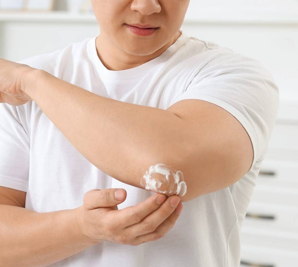 Eczema vs Dry Skin Care - Rating Roche Posay & Sarna Cream