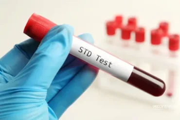 std